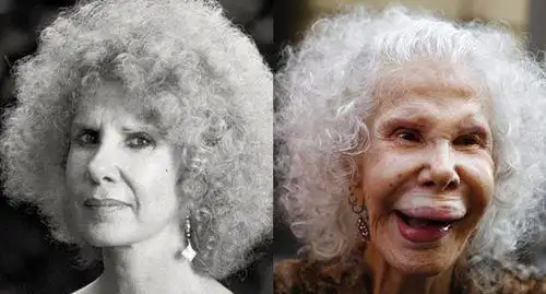 明星整容前后照片对比惊人 整容失败惨不忍睹的十大女星