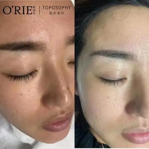 小姐姐在用了7天感恩反馈:毛孔细腻了法令纹,抬头纹明显淡化,皮肤紧致