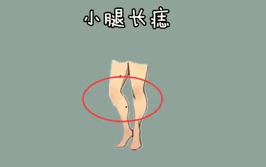 小腿长痣在相学当中,若是一个人的小腿的位置处长有吉痣,痣相大而黑亮