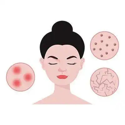 医美科普如何通过医美方式改善毛孔粗大