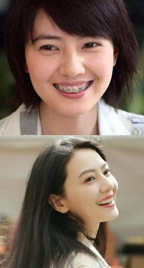 说刘亦菲丑的别拿畸形审美绑架她