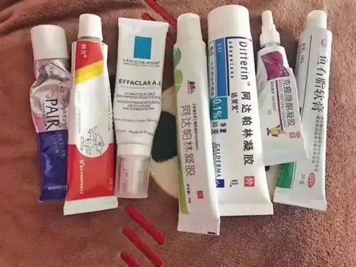 牛皮癣银屑病需要注意什么,皮肤病患者怎样识别激素药?