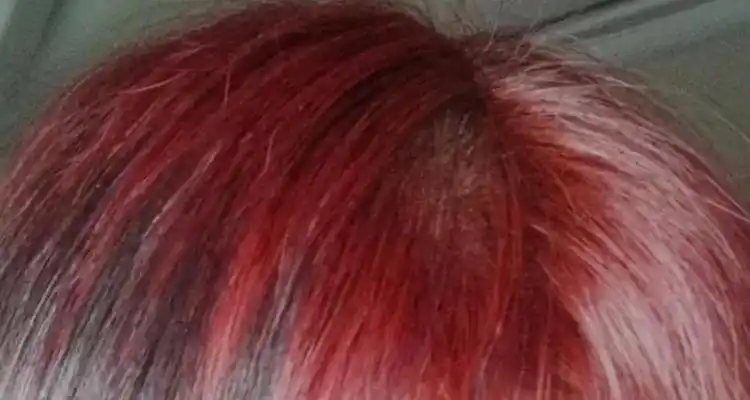 染发爆顶是什么原因