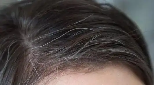 以上这些方法不一定能让已经变白了的头发变黑,但有可能防止白