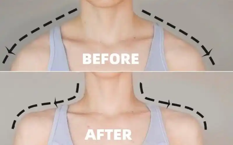 aprilhan改善斜方肌