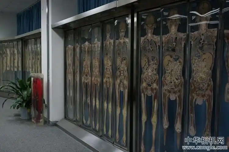 周末参观医学院人体标本室,胆小勿进