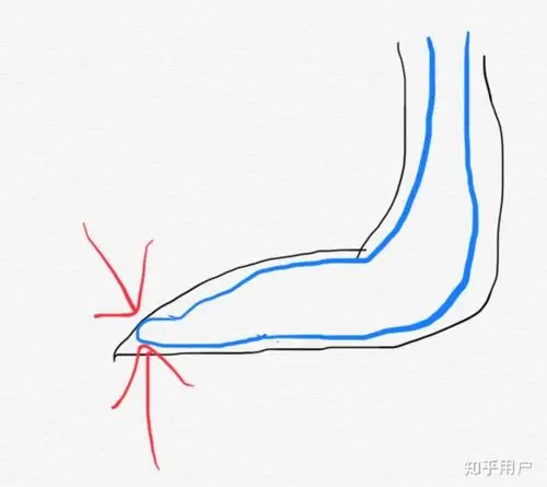 3:裤袜狭窄的脚尖部位空间不足,脚趾相互挤在一起的力.