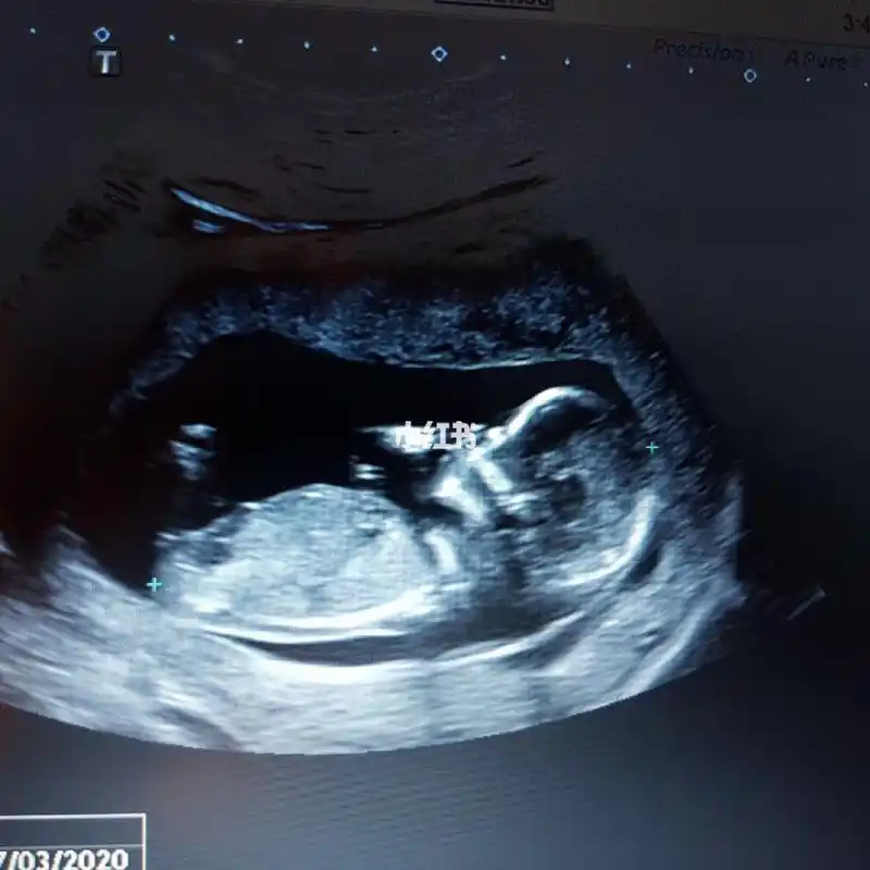 12周5的混血女宝宝