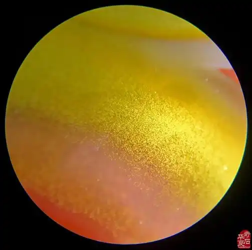 上谷战国红玛瑙的微观世界 组图