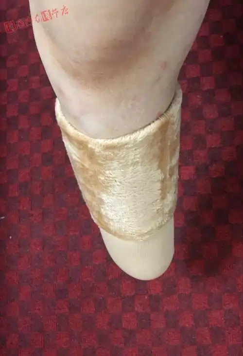 2只装加厚绒毛袜纯棉残肢袜残疾人袜子小腿截肢袜假肢袜套义肢袜 宽10