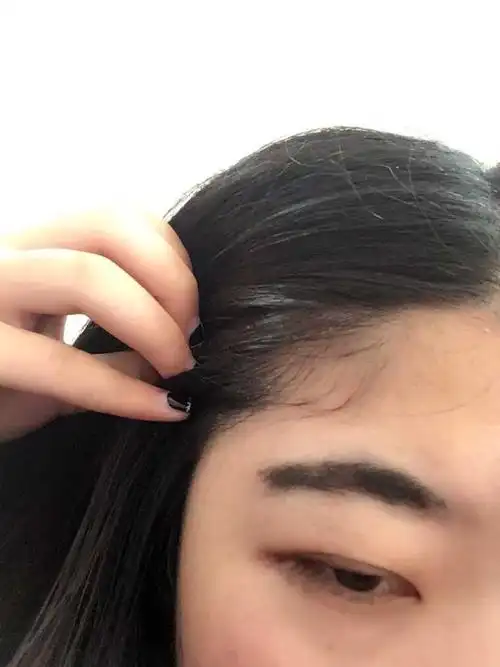 发际线以及头顶有很多小碎发怎么去除?