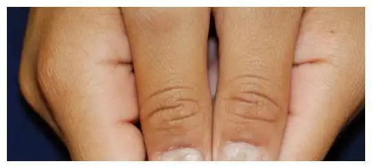 肝不好的人,身体往往有一黄二黑二臭,如果你有,需要提高警惕