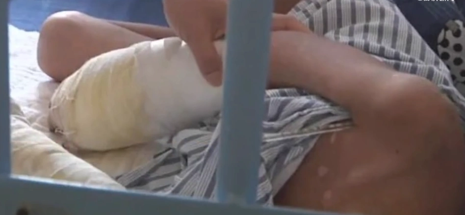 原创7岁男童被父亲虐待到面临截肢有些人自愿不育就是造福了