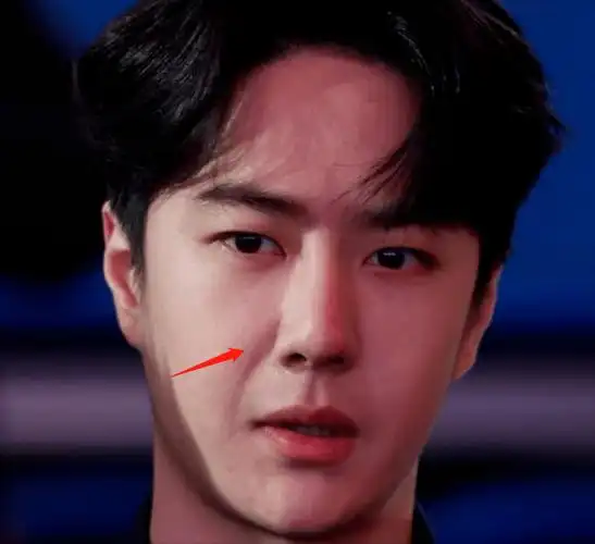 原创王一博新剧状态堪忧整容后遗症明显年代戏镜头里全暴露