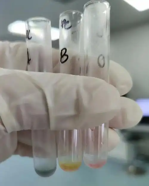 不规则抗体筛查1-3号谱细胞均出现凝集,没有反应格局.