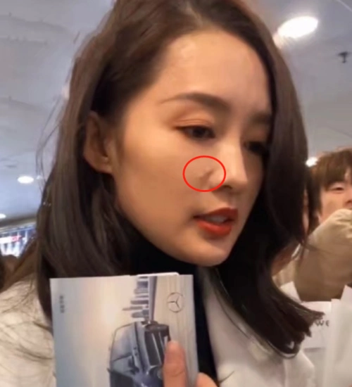 李沁赶飞机,粉丝凑近看清脸上的"痘痘",网友:不羡慕了!
