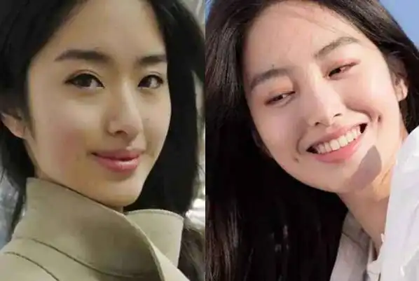 在某个网站中,就有网友po出杨采钰整容前的照片,前后对比简直判若两人