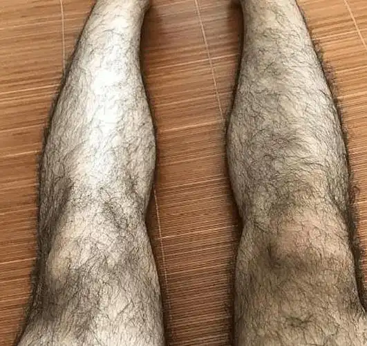 为什么有些男生腿毛浓密有些男生光秃秃涨知识了