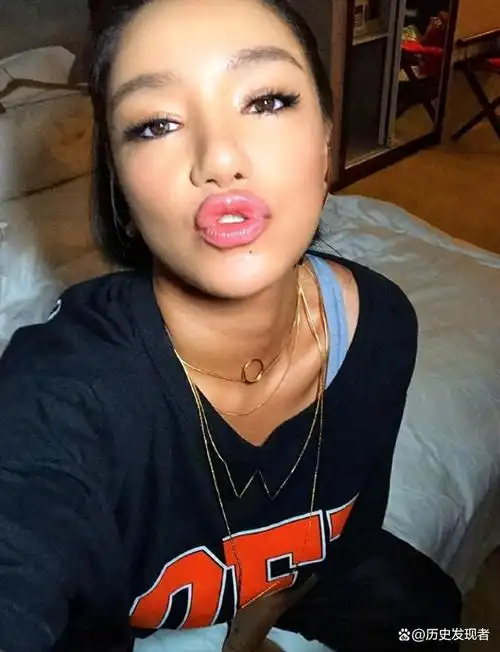 超级女声冠军江映蓉:整容失败像"怪物",全身只剩眼珠