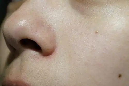 我的肤质:鼻子与脸颊的毛孔,有开放型粉刺,素颜看起来会一点一点的