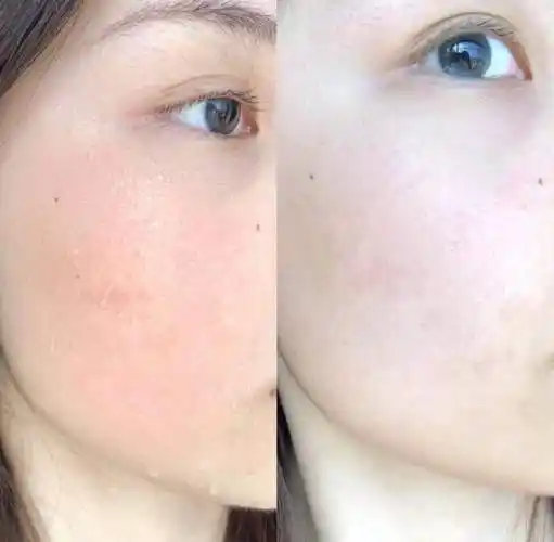 时期来用,我有时候换季脸上容易泛红什么的,不太敢用功能太多的护肤