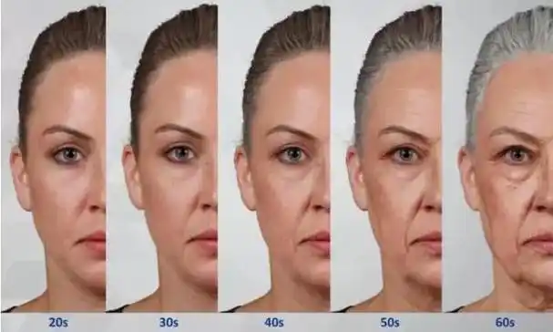 脸部衰老是从鼻唇沟加深开始的,这是因为随着年龄增长,面部中间的上颌