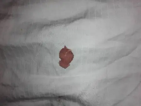 我和女朋友都是第一次做爱,但是没有在床单上发现血迹,而是在被套上