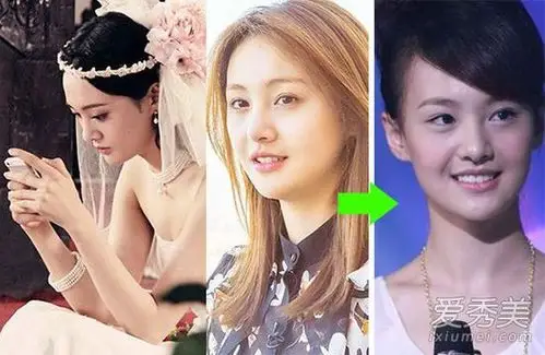 郑爽整容前后