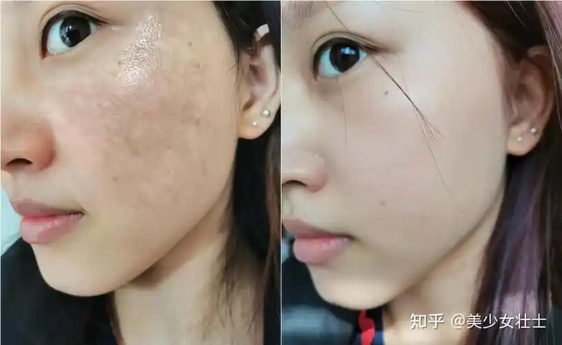 中科院博士告诉你想要美白/祛黄/嫩肤,一定要用有备案的美白面霜!