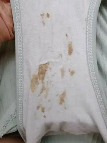 怀孕十个周,最近三四天发现内裤上有像血又不是血的分泌物,我想问一下