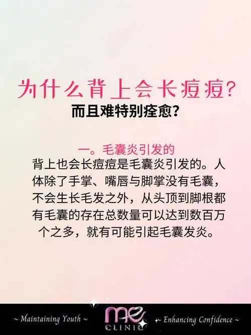 而且难特别痊愈?一.毛囊炎引发的背上也会长痘痘是毛囊炎引发的.