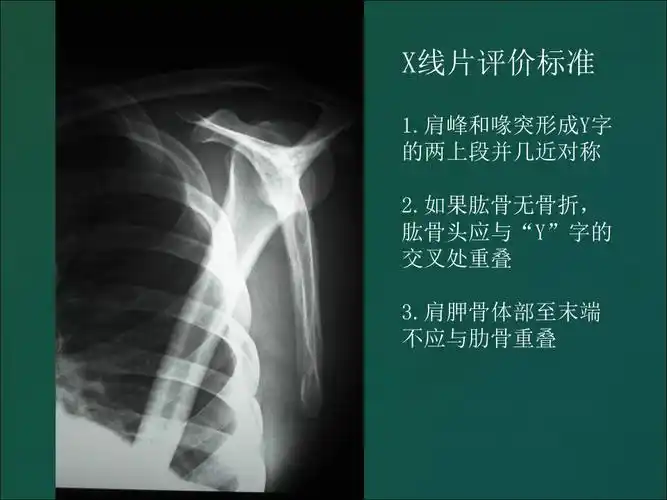 一文了解肩部x线片拍摄方法