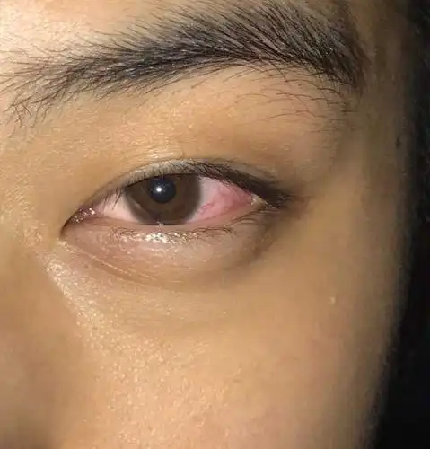 经常吸大麻的人跟正常人有什么区别