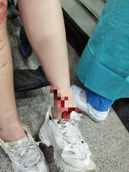 路遇车祸险情医生下班途中顺手又救了一个小女孩