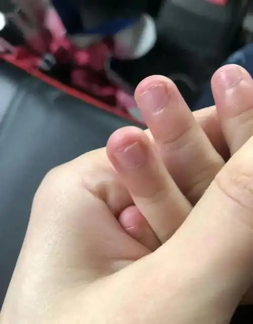 孩子从幼儿园到小学经常咬指甲?妈妈要关心几个细节
