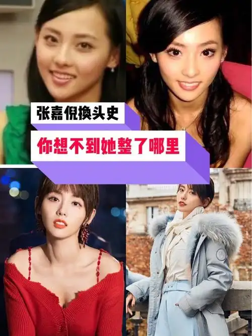 张嘉倪整容换头史你想不到的她动了哪里96张嘉倪是标准_圈子-新氧
