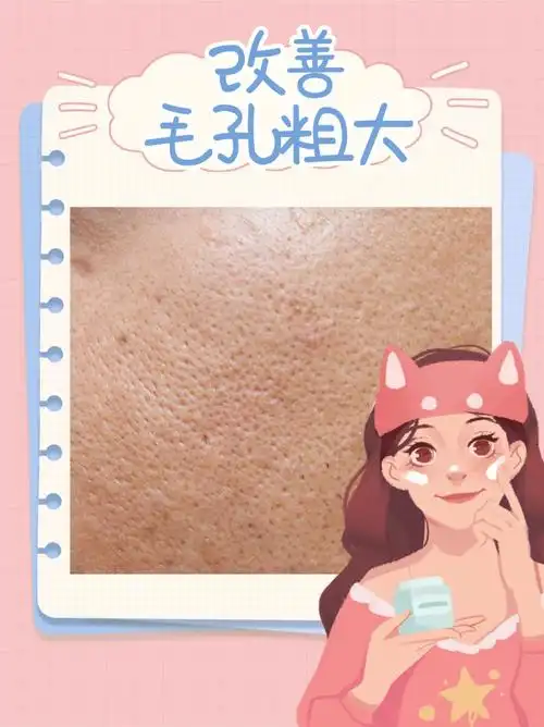 毛孔粗大怎么办71教你正确护肤75