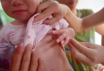 儿童性早熟诊断要点和检查