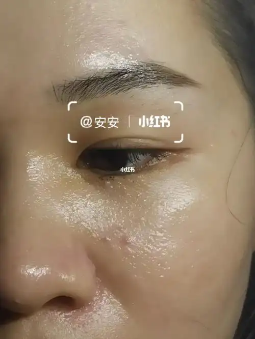 夏天大油皮们还好吗