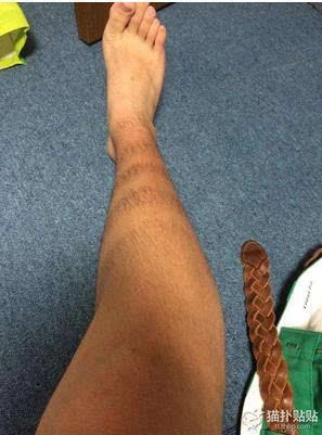 男生剃前卫腿毛爆红网友留言敢这样出门你是勇者