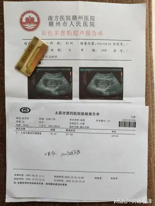 女性在怀孕早期会出现褐色分泌物是什么情况确定妊娠后不准备生育|血