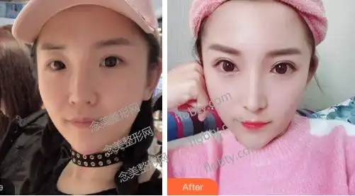 之后便一直从事这些美容工作,目前已经拥有很多成功案例,尤其是在实施