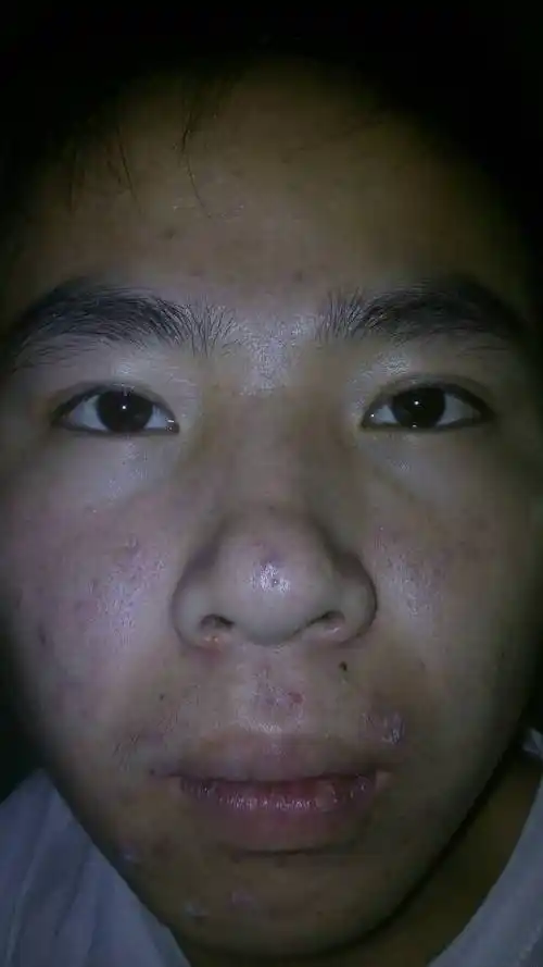 看看这皮肤能不能治,有没有好的化妆品