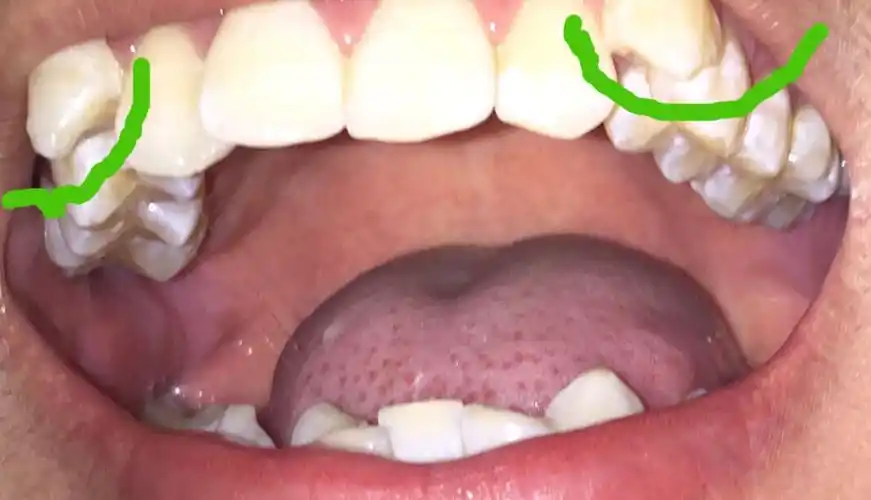  我来答 分享 微信扫一扫 新浪微博 qq空间  浏览 6 次 提示该问题