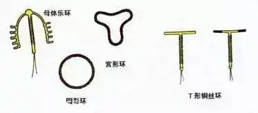 产后避孕,你会选择带环吗?