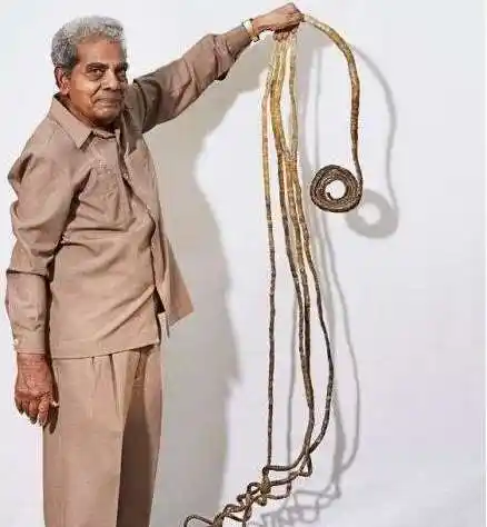 世界上指甲最长的人在他的所有指甲中又属大拇指的指甲最长