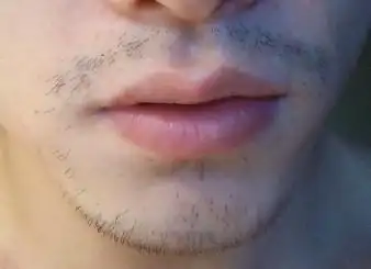 听说刮后会变硬,我现在这个胡子好像有点变硬了,有点像成人的胡子还