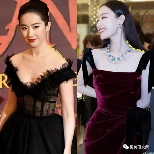 两边斜方肌上各注射适量肉毒素就能解决.