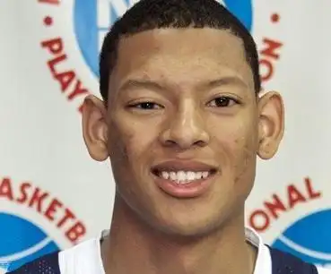 像体坛明星伊赛亚-奥斯汀,张佳迪也是因为马方综合征而不得不结束