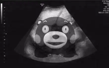 女孩告诉男友她怀孕了,对方看过b超单后大骂"智障"!聊天记录流出